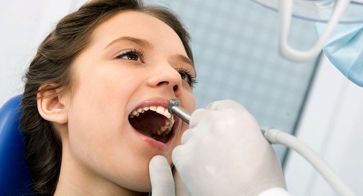 اسعار علاج جذور الأسنان