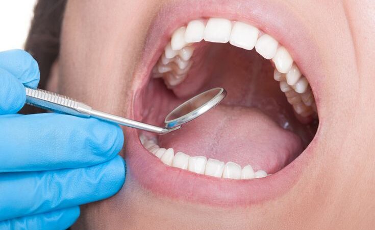 التهاب عصب الأسنان