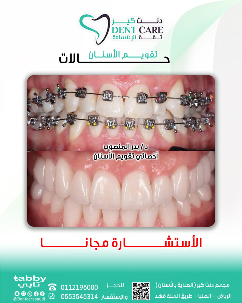 خالة2