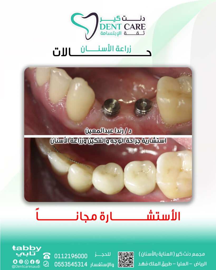 رننددد صص-Recovered 1
