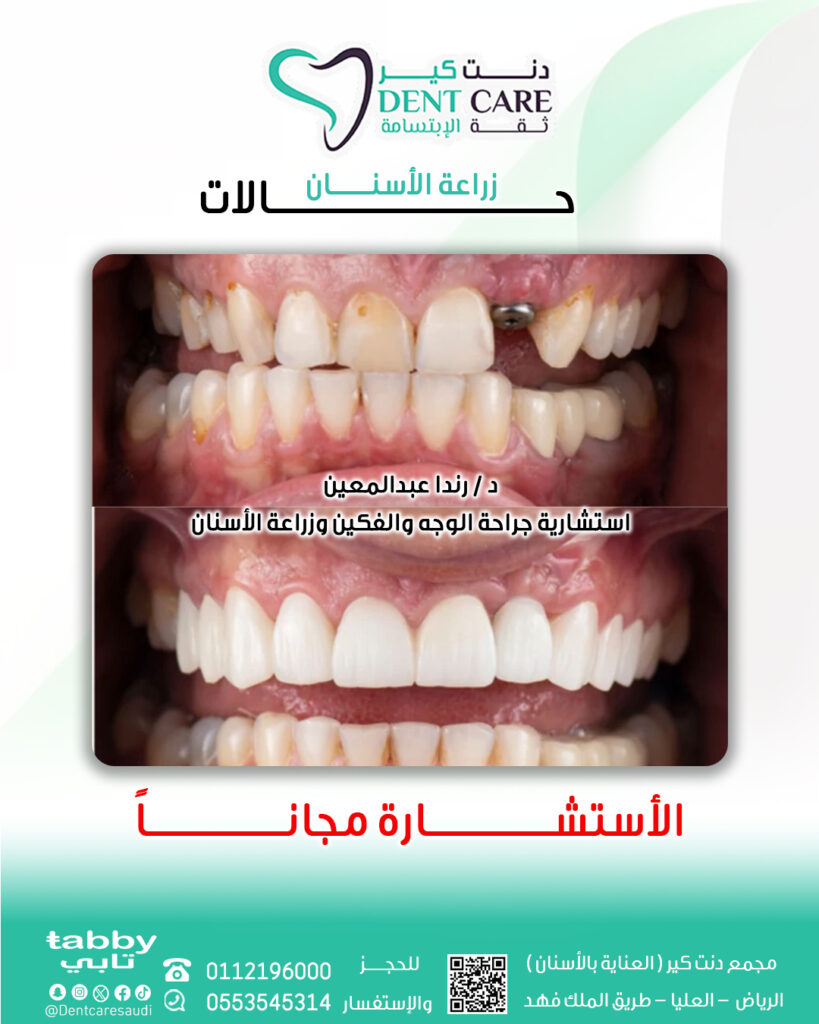 رننددد صص-Recovered 2