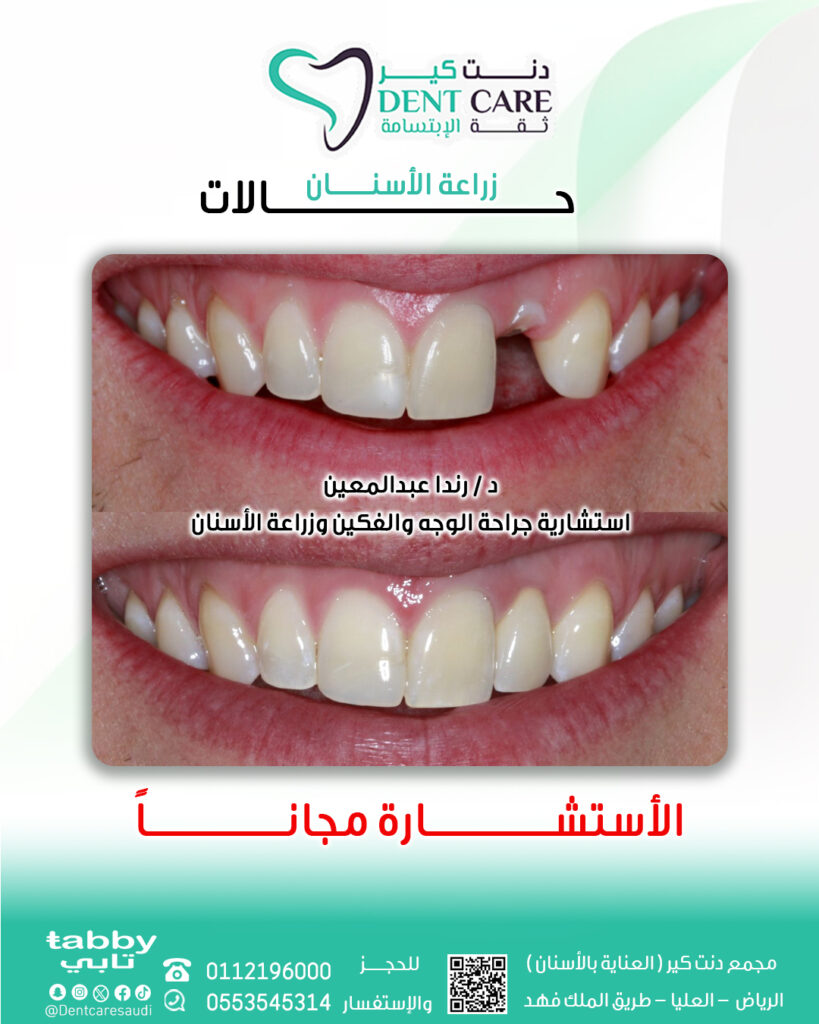 رننددد صص-Recovered 3
