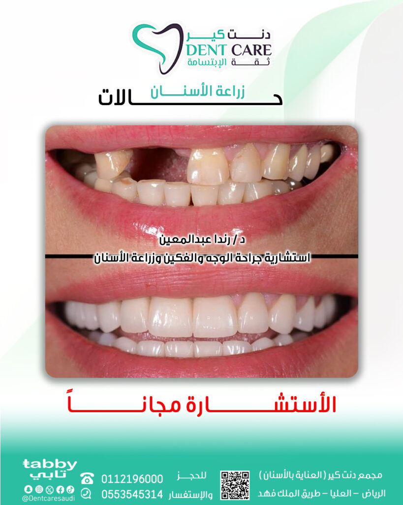 رننددد صص-Recovered 4
