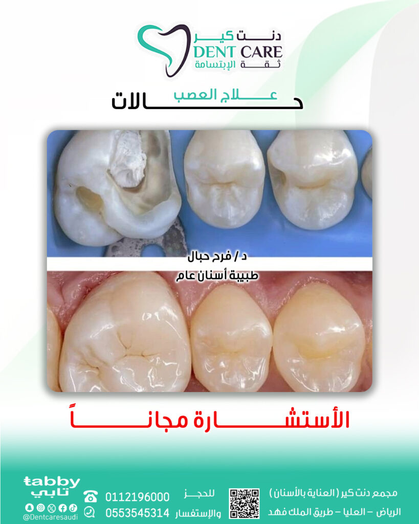 عصب فرح