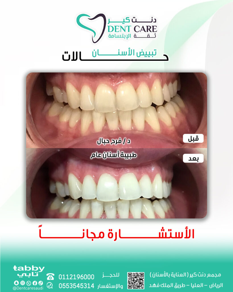 فرح تبييض