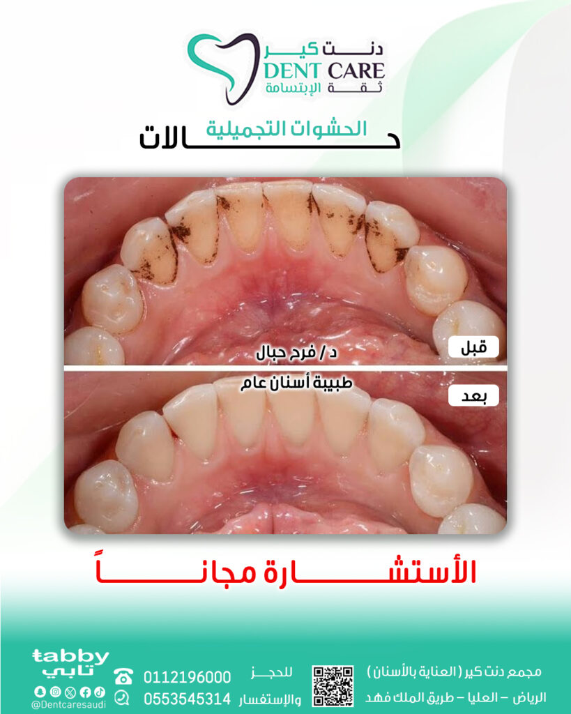 فرح صور