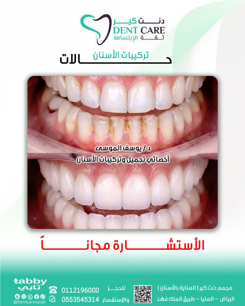 يوسف 1